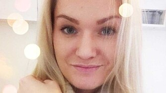 MARNA HAUGEN valgte å la seg filme under behandling for å informere om at man kan få et naturlig og fint resultat. MARNA HAUGEN valgte å la seg filme under behandling for å informere om at man kan få et naturlig og fint resultat.
