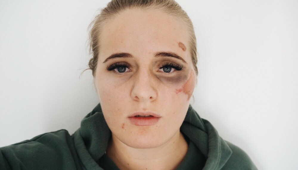 Dette bildet delte Martine på bloggen dagen etter at hun ble overfalt. Dette bildet delte Martine på bloggen dagen etter at hun ble overfalt.