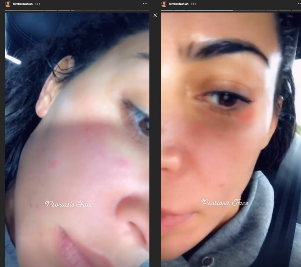 UTEN SMINKE: Kim Kardashian viste frem huden sin uten sminke på Instagram story. UTEN SMINKE: Kim Kardashian viste frem huden sin uten sminke på Instagram story.