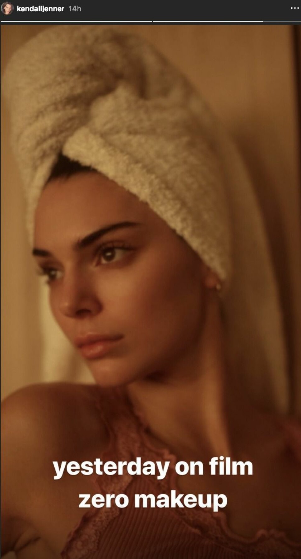 UTEN SMINKE: Kendall Jenner på modelloppdrag uten sminke. UTEN SMINKE: Kendall Jenner på modelloppdrag uten sminke.
